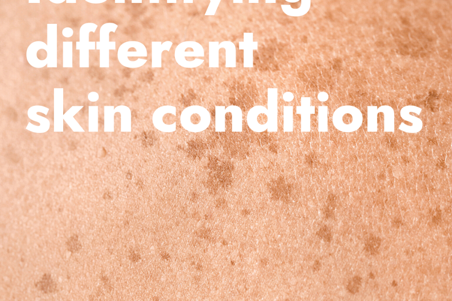 Different skin conditions